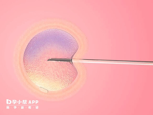 南京试管婴儿医院成功率在30%-60%左右