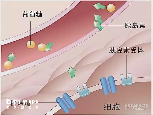 胰岛素抵抗图示