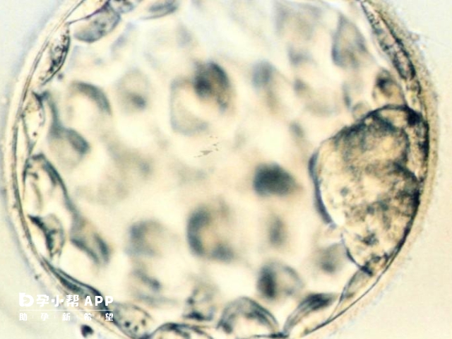 7项不孕抗体包括抗绒毛膜促性腺激素