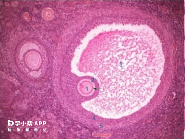 排卵后24小时内卵泡壁塌陷消失